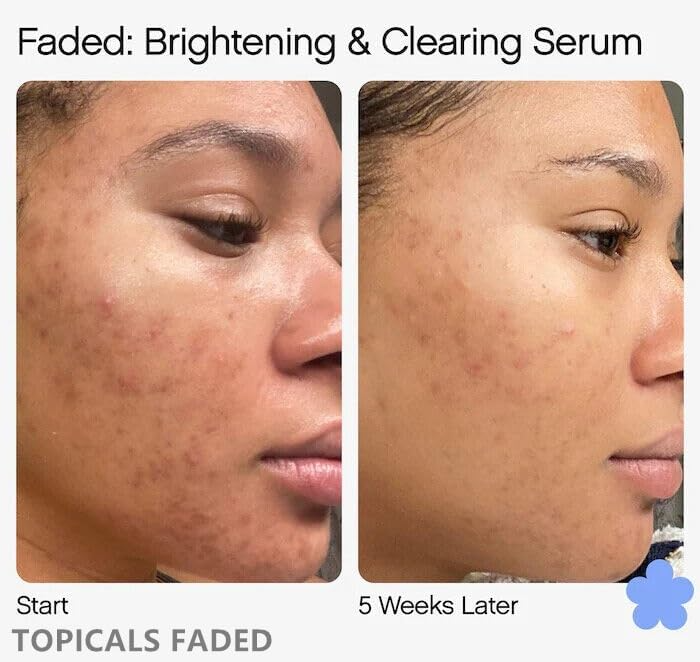 TOPICALS FADED Serum Vegan, Gluten-Free and Cruelty-Free- 1.7OZ/50ML(NEW VERSION)