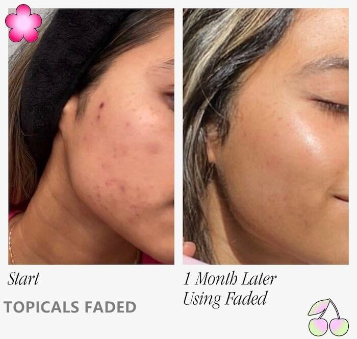 TOPICALS FADED Serum Vegan, Gluten-Free and Cruelty-Free- 1.7OZ/50ML(NEW VERSION)