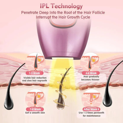 IPL Hair Removal Device
