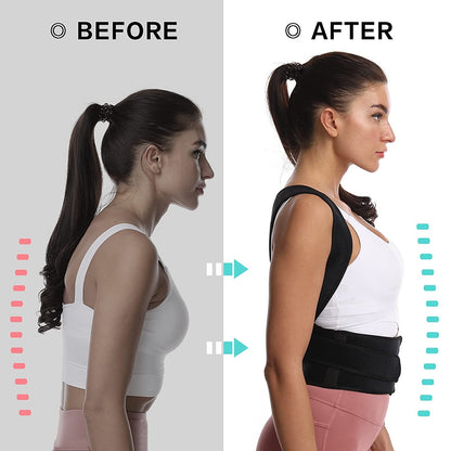 Posture Corrector Belt – Back & Shoulder Support