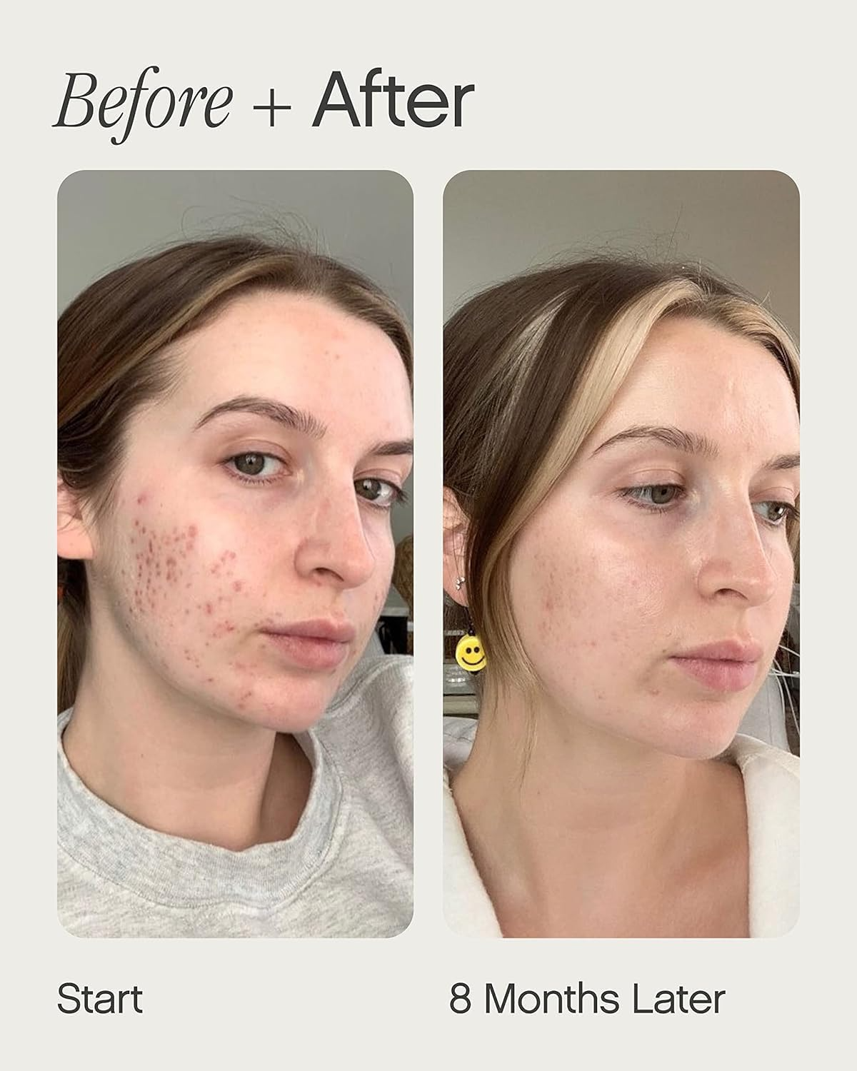 🌟 Topicals Mini Faded Serum for Dark Spots & Discoloration – 15ml / 0.5 fl oz