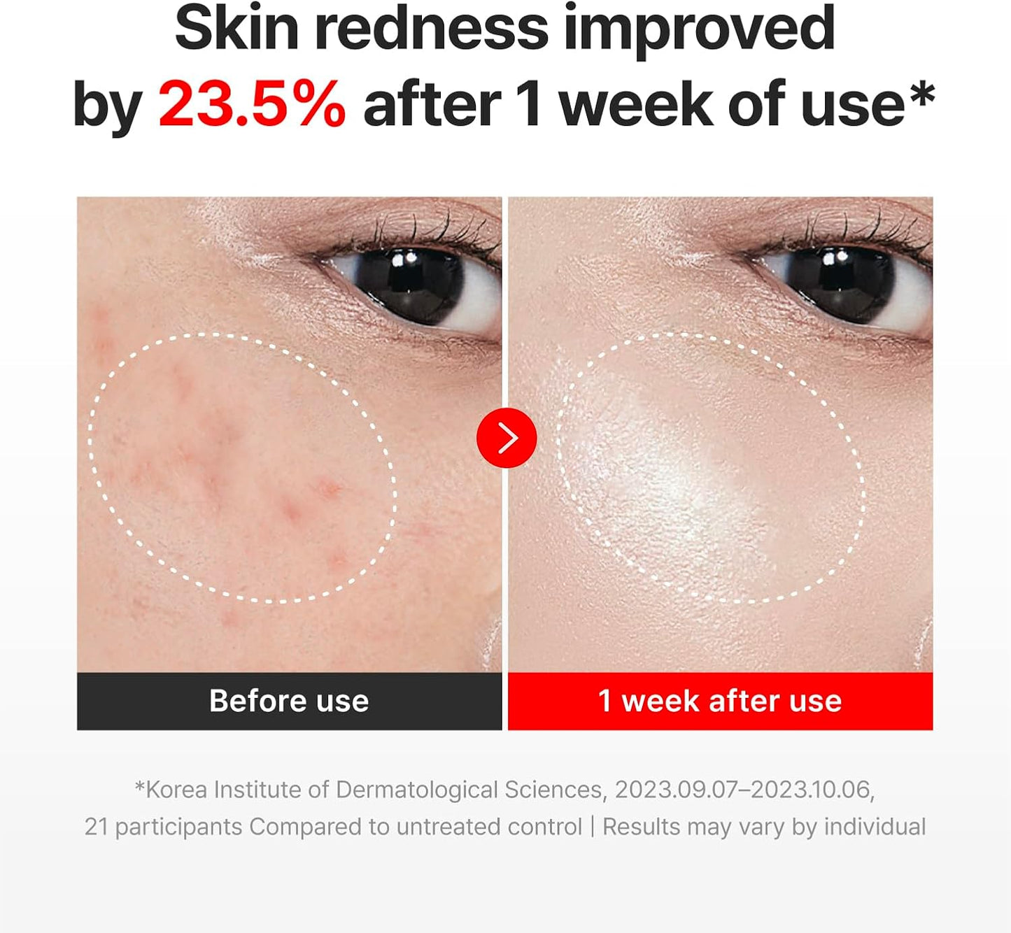 ✨ Madeca Time Reverse Cream – Anti-Aging Glow Moisturizer 💖