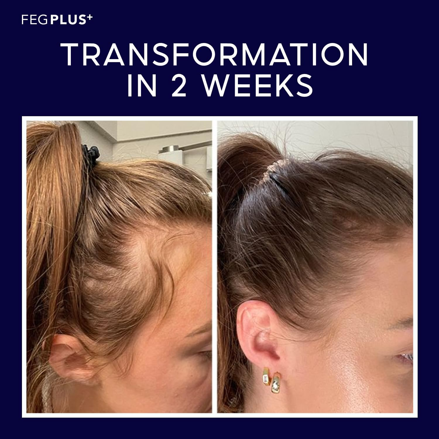 🌿 FEGPLUS Minoxidil Hair & Beard Growth Serum (50ml)