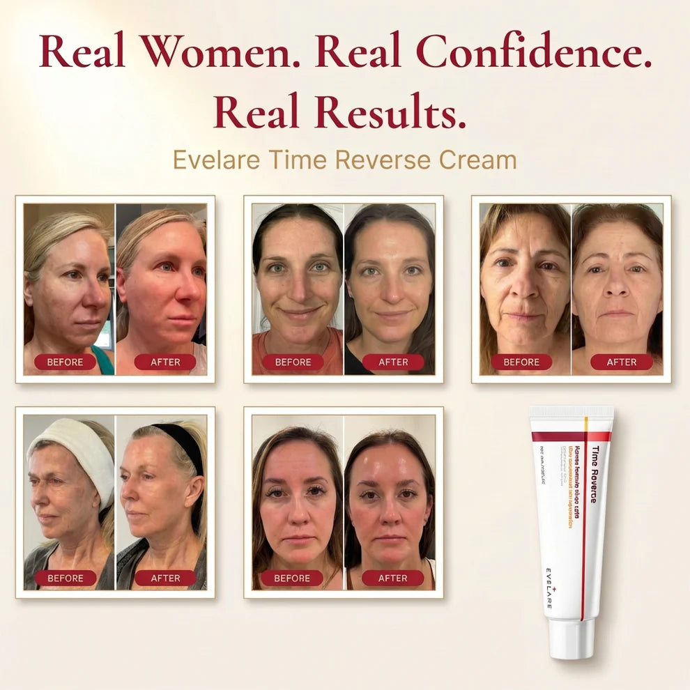 ✨🌸 Evelare Time Reverse Cream – Anti-Aging & Skin Repair